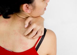 Ce stim despre boala de piele, denumita lichen plan?