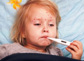 Bolile infectioase ale copilariei